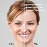 anti-aging device anti-sagging jowls anti-wrinkle gadget