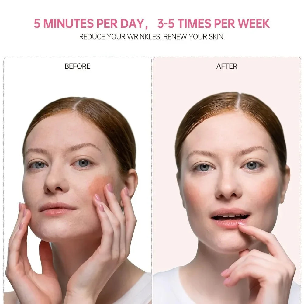 at‑home red light skincare tool