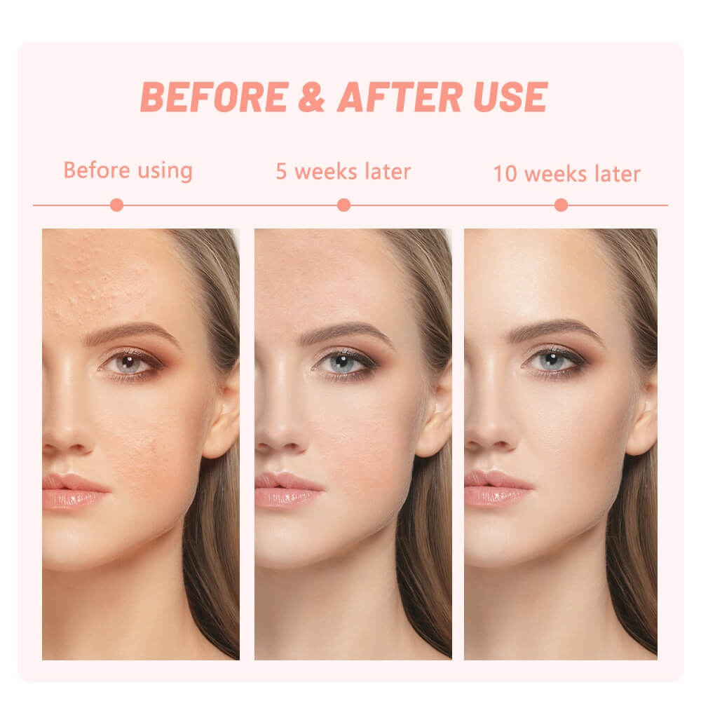 led facial therapy home spa gift for her