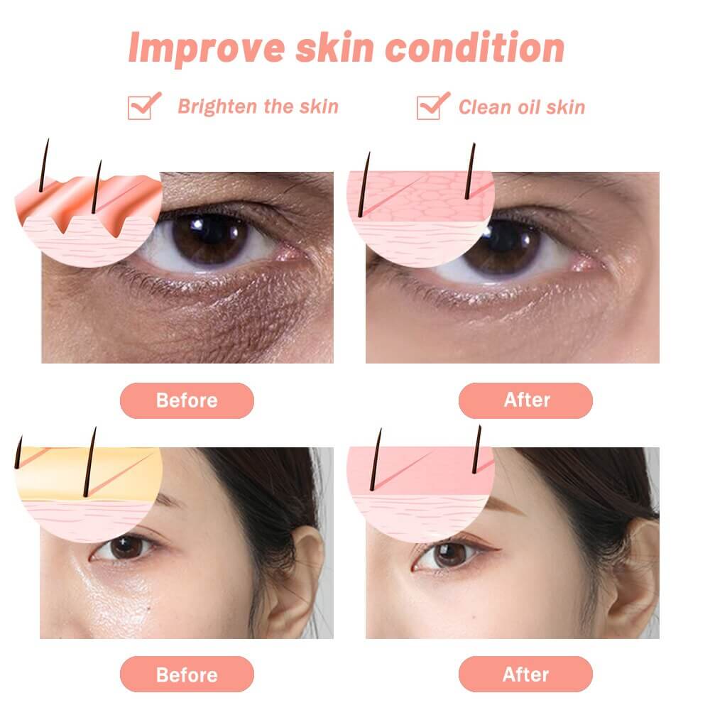 led facial therapy home spa gift for her